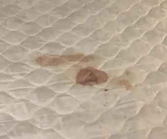 Mattress Blood Stain Removal